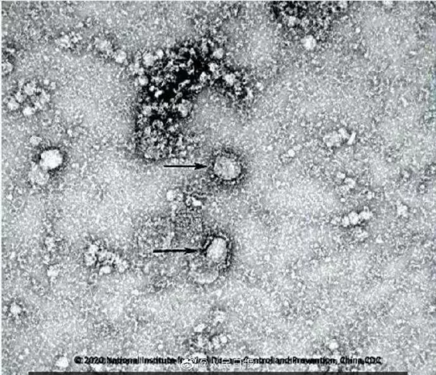 Уханьские врачи назвали неожиданные симптомы нового коронавируса