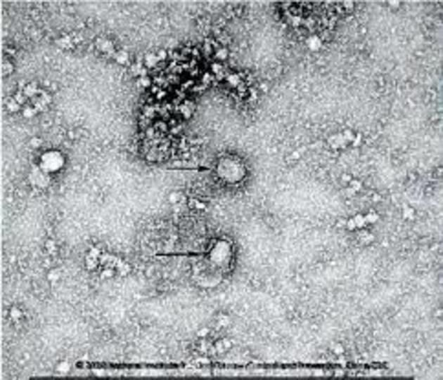 ВОЗ призвала не паниковать из-за коронавируса