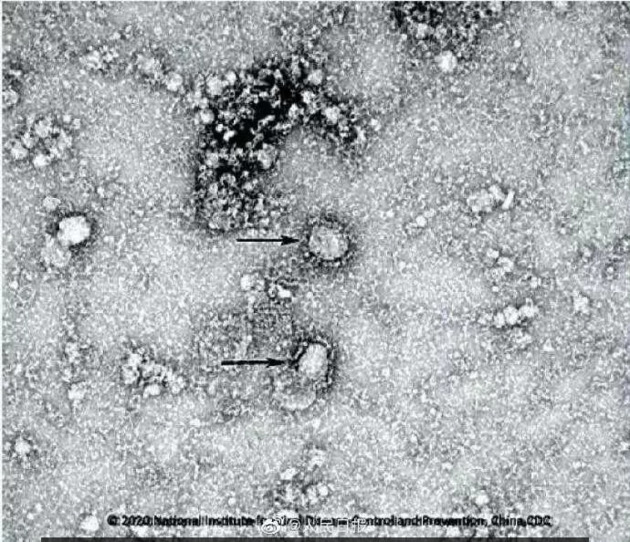 Вспышка нового коронавируса имеет потенциал пандемии - ВОЗ