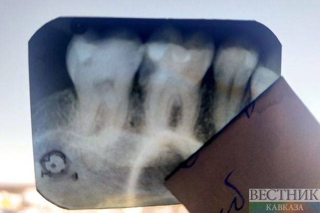 Стоматолог рассказала, чем опасен коронавирус для зубов