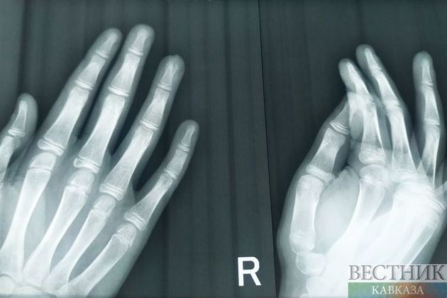 Селянин сломал челюсть 11-летнему ребенку в Казахстане