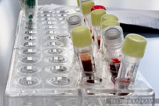 Анализ крови