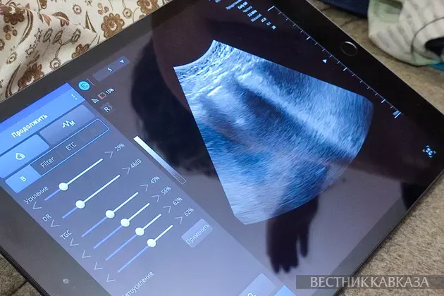 Аппарат УЗИ