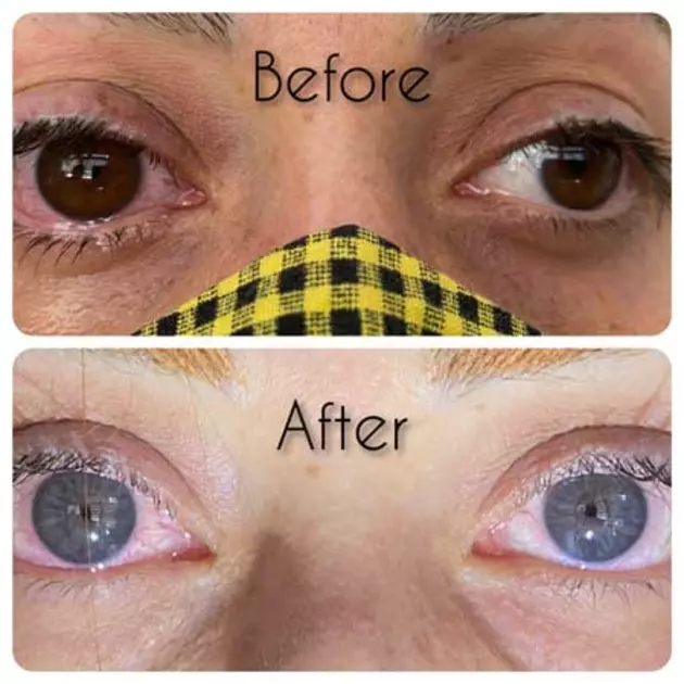 За голубой мечтой: как соцсети заставляют иранцев рисковать зрением ради тренда