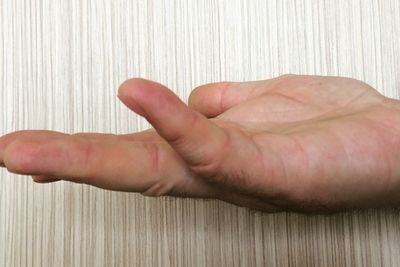 Дагестанские травматологи научились лечить болезнь &quot;скрюченных пальцев&quot;