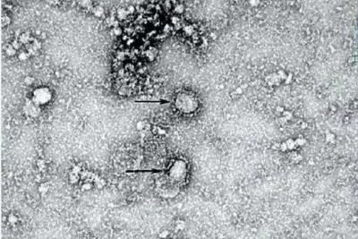 Эксперт Минздрава оценил риск появления коронавируса в России