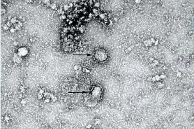 Первый случай заболевания коронавирусом подтвердили в Бразилии