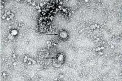 В Ираке зафиксирована первая смерть от коронавируса 