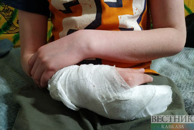 Ребенку оторвало пальцы петардой в Кабардино-Балкарии